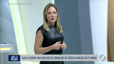 itemSeparação de gêmeas siamesas Eliza e Yasmim em Goiânia