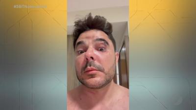 itemEmpresário agredido pela ex-namorada em Anápolis fala ao SBTN-GO