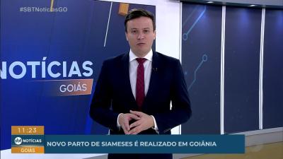 itemNovo parto de siameses é realizado em Goiânia