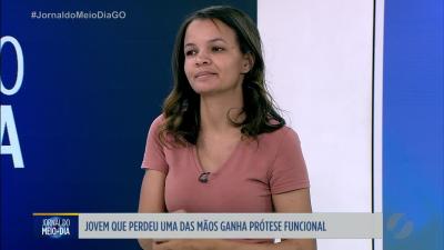 itemJovem que perdeu uma das mãos ganha prótese funcional